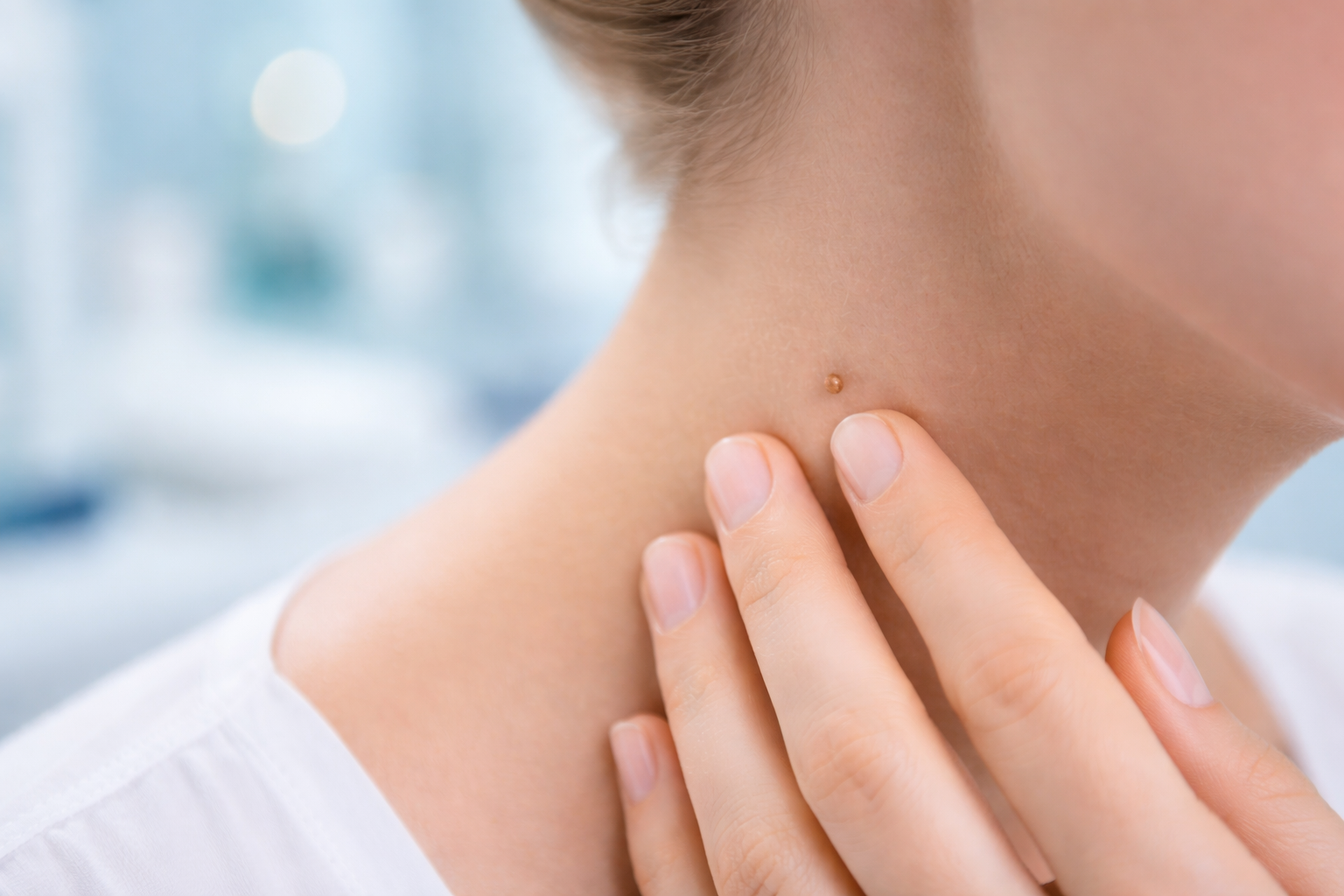 A close-up of a person's skin with a small mark, softly lit to show texture and detail.